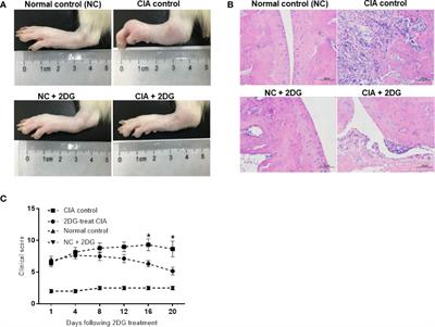 2-Deoxy-D-glucose Alleviates Collagen-Induced Arthritis of Rats and Is Accompanied by Metabolic Regulation of the Spleen and Liver